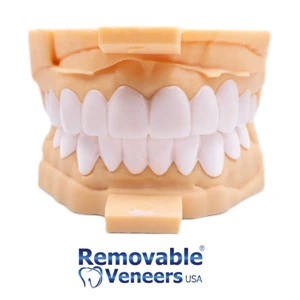 top5 Best ​​Snap-On Veneers 2026