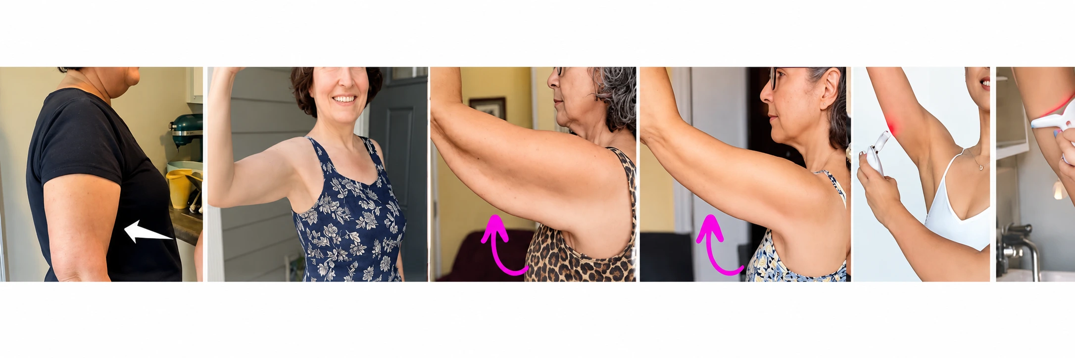 ChatGPTImage20265909_48_57 Top Arm Sculpting Devices
